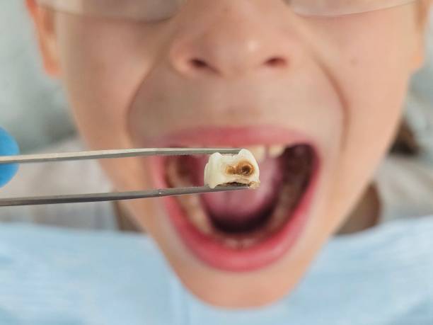 Best Broken or Cracked Tooth Emergency Dentist in Dimmitt, TX